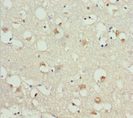 Immunohistochemistry of paraffin-embedded human brain tissue using CSB-PA009593DSR2HU at dilution of 1:100