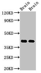 Western Blot Positive WB detected in: Rat brain tissue, Mouse brain tissue All lanes: Gnao1 antibody at 3µg/ml Secondary Goat polyclonal to rabbit IgG at 1/50000 dilution Predicted band size: 41 kDa Observed band size: 41 kDa