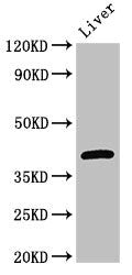 Western Blot Positive WB detected in: Mouse liver tissue All lanes: GNAT1 antibody at 3ug/ml Secondary Goat polyclonal to rabbit IgG at 1/50000 dilution Predicted band size: 41 kDa Observed band size: 41 kDa