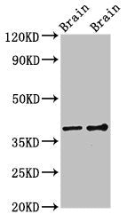 Western Blot Positive WB detected in: Rat brain tissue, Mouse brain tissue All lanes: GNB1 antibody at 3ug/ml Secondary Goat polyclonal to rabbit IgG at 1/50000 dilution Predicted band size: 38, 37 kDa Observed band size: 38 kDa