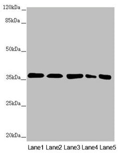 Western blot All lanes: GNB2 antibody at 2.22µg/ml Lane 1: Mouse lung tissue Lane 2: NIH/3T3 whole cell lysate Lane 3: Jurkat whole cell lysate Lane 4: 293T whole cell lysate Lane 5: Hela whole cell lysate Secondary Goat polyclonal to rabbit IgG a...
