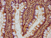IHC image of CSB-PA009605LA01HU diluted at 1:500 and staining in paraffin-embedded human small intestine tissue performed on a Leica BondTM system. After dewaxing and hydration, antigen retrieval was mediated by high pressure in a citrate buffer (...
