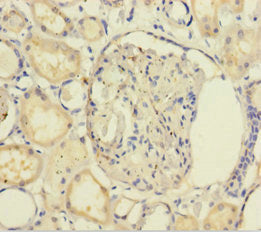Immunohistochemistry of paraffin-embedded human kidney tissue using CSB-PA009608LA01HU at dilution of 1:100