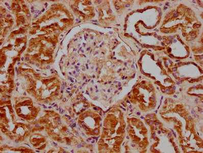 IHC image of CSB-PA009614OA01HU diluted at 1:100 and staining in paraffin-embedded human kidney tissue performed on a Leica BondTM system. After dewaxing and hydration, antigen retrieval was mediated by high pressure in a citrate buffer (pH 6.0)....