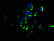 Immunofluorescence staining of MCF-7 cells with CSB-PA009619LA01HU at 1:133, counter-stained with DAPI. The cells were fixed in 4% formaldehyde, permeabilized using 0.2% Triton X-100 and blocked in 10% normal Goat Serum. The cells were then incuba...