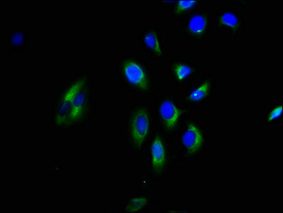 Immunofluorescence staining of A549 cells with CSB-PA009622LA01HU at 1:200, counter-stained with DAPI. The cells were fixed in 4% formaldehyde, permeabilized using 0.2% Triton X-100 and blocked in 10% normal Goat Serum. The cells were then incubat...