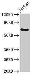 Western Blot Positive WB detected in: Jurkat whole cell lysate All lanes: GNL1 antibody at 3.2µg/ml Secondary Goat polyclonal to rabbit IgG at 1/50000 dilution Predicted band size: 69, 48 kDa Observed band size: 69 kDa