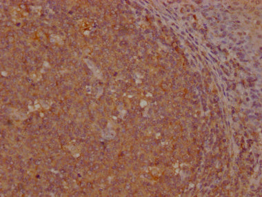 IHC image of CSB-PA009627LA01HU diluted at 1:200 and staining in paraffin-embedded human tonsil tissue performed on a Leica BondTM system. After dewaxing and hydration, antigen retrieval was mediated by high pressure in a citrate buffer (pH 6.0)....