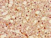 Immunohistochemistry of paraffin-embedded human brain tissue using CSB-PA009629LA01HU at dilution of 1:100