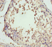 Immunohistochemistry of paraffin-embedded human testis tissue using CSB-PA009639ESR1HU at dilution of 1:100