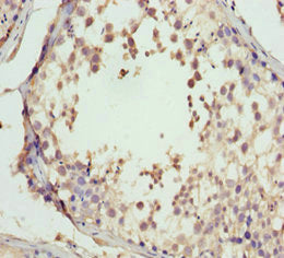 Immunohistochemistry of paraffin-embedded human testis tissue using CSB-PA009639ESR1HU at dilution of 1:100