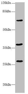 Western blot All lanes: GNS antibody at 3.61 ug/ml + Mouse liver tissue Secondary Goat polyclonal to rabbit IgG at 1/10000 dilution Predicted band size: 63, 60 kDa Observed band size: 63, 27, 37 kDa