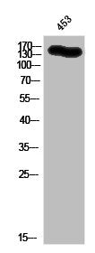 Western Blot analysis of 453 cells using c-Kit Polyclonal Antibody