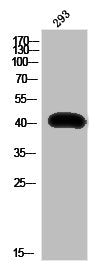 Western Blot analysis of 293 cells using Cleaved-Kininogen-1 HC (K380) Polyclonal Antibody