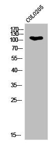 Western Blot analysis of COLO205 cells using Phospho-Eg5 (T926) Polyclonal Antibody