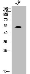 Western Blot analysis of 293 cells using Phospho-Cytokeratin 8 (S432) Polyclonal Antibody