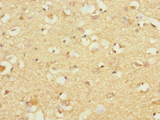 Immunohistochemistry of paraffin-embedded human brain tissue using CSB-PA009686ESR1HU at dilution of 1:100