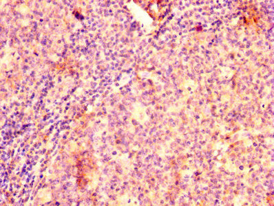 IHC image of CSB-PA00969A0Rb diluted at 1:500 and staining in paraffin-embedded human tonsil tissue performed on a Leica BondTM system. After dewaxing and hydration, antigen retrieval was mediated by high pressure in a citrate buffer (pH 6.0). Sec...