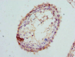 Immunohistochemistry of paraffin-embedded human testis tissue using CSB-PA009711ESR2HU at dilution of 1:100