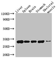 Western Blot Positive WB detected in: Mouse liver tissue, Mouse spleen tissue, Mouse brain tissue, Mouse stomach tissue, Mouse skeletal muscle tissue All lanes: GPM6A antibody at 4ug/ml Secondary Goat polyclonal to rabbit IgG at 1/50000 dilution P...