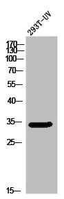 Western Blot analysis of 293T-UV cells using Olfactory receptor 5W2 Polyclonal Antibody