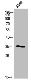 Western Blot analysis of A549 cells using Olfactory receptor 5B12 Polyclonal Antibody