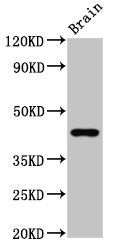 Western Blot Positive WB detected in: Rat brain tissue All lanes: GPR14 antibody at 3.7ug/ml Secondary Goat polyclonal to rabbit IgG at 1/50000 dilution Predicted band size: 44 kDa Observed band size: 44 kDa