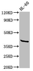 Western Blot Positive WB detected in: HL60 whole cell lysate All lanes: GPR32 antibody at 2.6µg/ml Secondary Goat polyclonal to rabbit IgG at 1/50000 dilution Predicted band size: 41 kDa Observed band size: 41 kDa