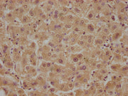 IHC image of CSB-PA009810OA01HU diluted at 1:100 and staining in paraffin-embedded human liver tissue performed on a Leica BondTM system. After dewaxing and hydration, antigen retrieval was mediated by high pressure in a citrate buffer (pH 6.0). S...