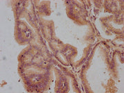 IHC image of CSB-PA009820OA01HU diluted at 1:100 and staining in paraffin-embedded human prostate tissue performed on a Leica BondTM system. After dewaxing and hydration, antigen retrieval was mediated by high pressure in a citrate buffer (pH 6.0)...