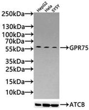 Western Blot Positive WB detected in: HepG2 whole cell lysate(30µg), Hela whole cell lysate(30µg), SY5Y whole cell lysate(30µg) All lanes: GPR75 antibody at 1:1000 Secondary Goat polyclonal to rabbit IgG at 1/20000 dilution Predicted band size: 60...