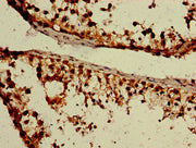 Immunohistochemistry of paraffin-embedded human testis tissue using CSB-PA009837LA01HU at dilution of 1:100