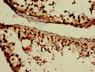 Immunohistochemistry of paraffin-embedded human testis tissue using CSB-PA009837LA01HU at dilution of 1:100