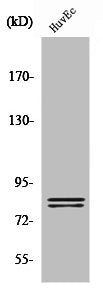Western Blot analysis of HuvEc cells using HSL Polyclonal Antibody