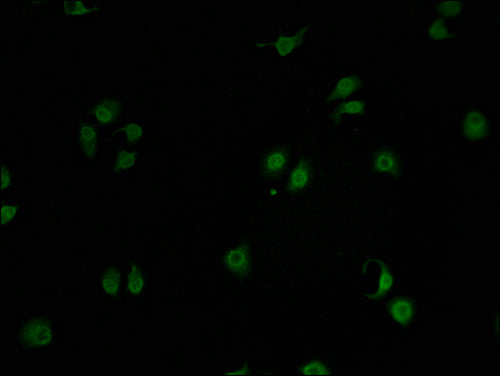 Immunofluorescence staining of A549 cells with CSB-PA009856LA01HU-IF at 1:100, counter-stained with DAPI. The cells were fixed in 4% formaldehyde and blocked in 10% normal Goat Serum. The cells were then incubated with the antibody overnight at 4°...
