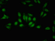 Immunofluorescent analysis of Hela cells using CSB-PA009859LA01HU at dilution of 1:100 and Alexa Fluor 488-congugated AffiniPure Goat Anti-Rabbit IgG(H+L)