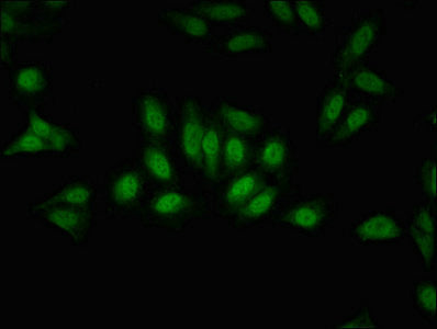 Immunofluorescent analysis of Hela cells using CSB-PA009859LA01HU at dilution of 1:100 and Alexa Fluor 488-congugated AffiniPure Goat Anti-Rabbit IgG(H+L)