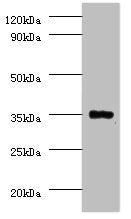 Western blot All lanes: Serine/threonine-protein phosphatase 2A catalytic subunit beta isoform Antibody at 2µg/ml + EC109 whole cell lysate Secondary Goat polyclonal to rabbit IgG at 1/15000 dilution Predicted band size: 34 kDa Observed band size:...