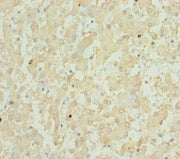 Immunohistochemistry of paraffin-embedded human liver tissue using CSB-PA009870DSR1HU at dilution of 1:100