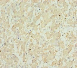 Immunohistochemistry of paraffin-embedded human liver tissue using CSB-PA009870DSR1HU at dilution of 1:100