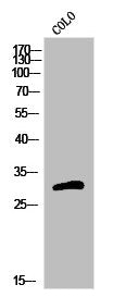 Western Blot analysis of COLO cells using Olfactory receptor 5H15 Polyclonal Antibody