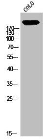 Western Blot analysis of CoLo cells using CD205 Polyclonal Antibody