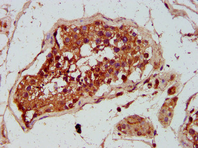 IHC image of CSB-PA009892LA01HU diluted at 1:300 and staining in paraffin-embedded human testis tissue performed on a Leica BondTM system. After dewaxing and hydration, antigen retrieval was mediated by high pressure in a citrate buffer (pH 6.0)....