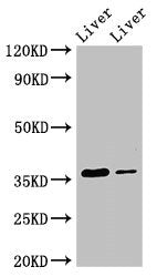 Western Blot Positive WB detected in: Rat liver tissue, Mouse liver tissue All lanes: GRHPR antibody at 3.5ug/ml Secondary Goat polyclonal to rabbit IgG at 1/50000 dilution Predicted band size: 36, 28 kDa Observed band size: 36 kDa