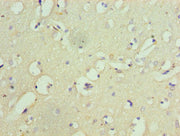 Immunohistochemistry of paraffin-embedded human brain tissue using CSB-PA009898ESR1HU at dilution of 1:100