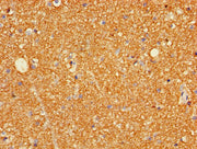 Immunohistochemistry of paraffin-embedded human brain tissue using CSB-PA009900LA01HU at dilution of 1:100