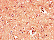 Immunohistochemistry of paraffin-embedded human brain tissue using CSB-PA009901LA01HU at dilution of 1:100