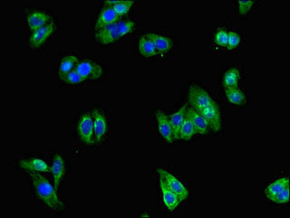 Immunofluorescent analysis of HepG2 cells using CSB-PA009911LA01HU at dilution of 1:100 and Alexa Fluor 488-congugated AffiniPure Goat Anti-Rabbit IgG(H+L)