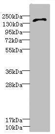 Western blot All lanes: GRIN2D antibody IgG at 3.65ug/ml + HepG2 whole cell lysate Secondary Goat polyclonal to rabbit IgG at 1/10000 dilution Predicted band size: 144 kDa Observed band size: 144 kDa