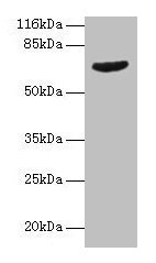 Western blot All lanes: GRK4 antibody at 2µg/ml + Jurkat whole cell lysate Secondary Goat polyclonal to rabbit IgG at 1/10000 dilution Predicted band size: 67, 64, 58, 62 kDa Observed band size: 67 kDa